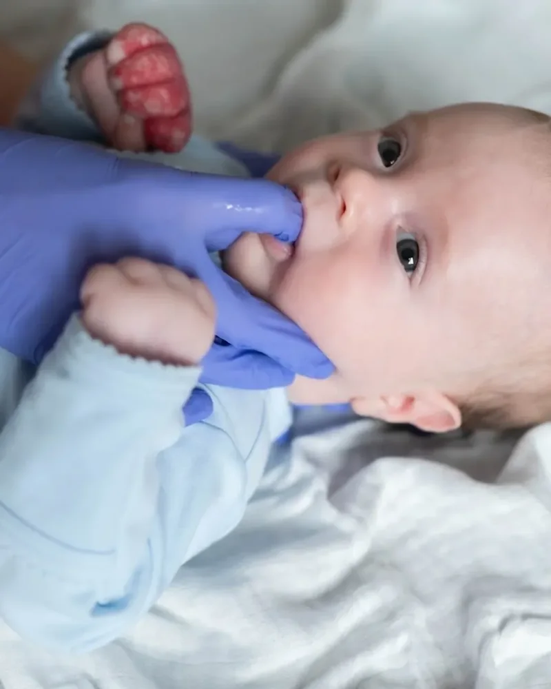 Gloved hand checking a baby's oral movement during a feeding assessment